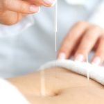 Acupuncture and Infertility Guide